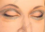 blepharoplastie superieure tunisie