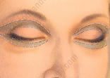 blepharoplastie superieure tunisie