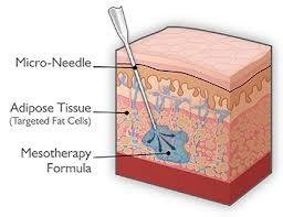 mesotherapie visage tunisie