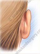 chirurgie oreilles tunisie